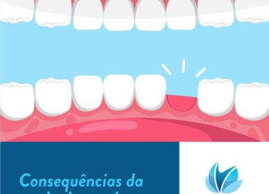 Dr. Rafael Pocztaruk perda de um dente