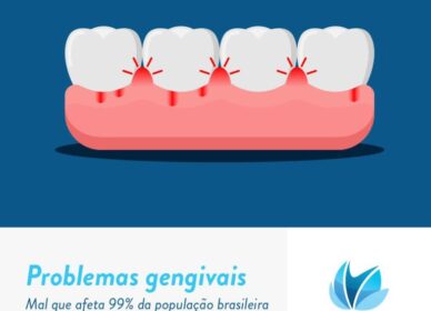 Dr. Rafael Pocztaruk Problemas gengivais