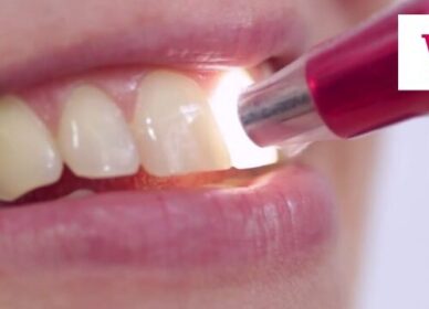 ClareamentoDental-500x432 ClareamentoDental-500x432