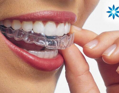 Dr. Rafael Pocztaruk Invisalign Porto Alegre